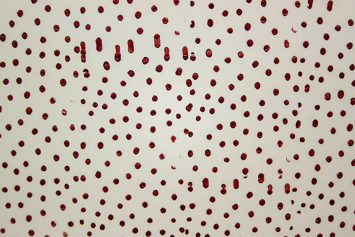 Detail of Christopher Wool's 'Untitled' (1987, 1989) painting, featuring a pattern of irregular dark red dots and drips on a light background.